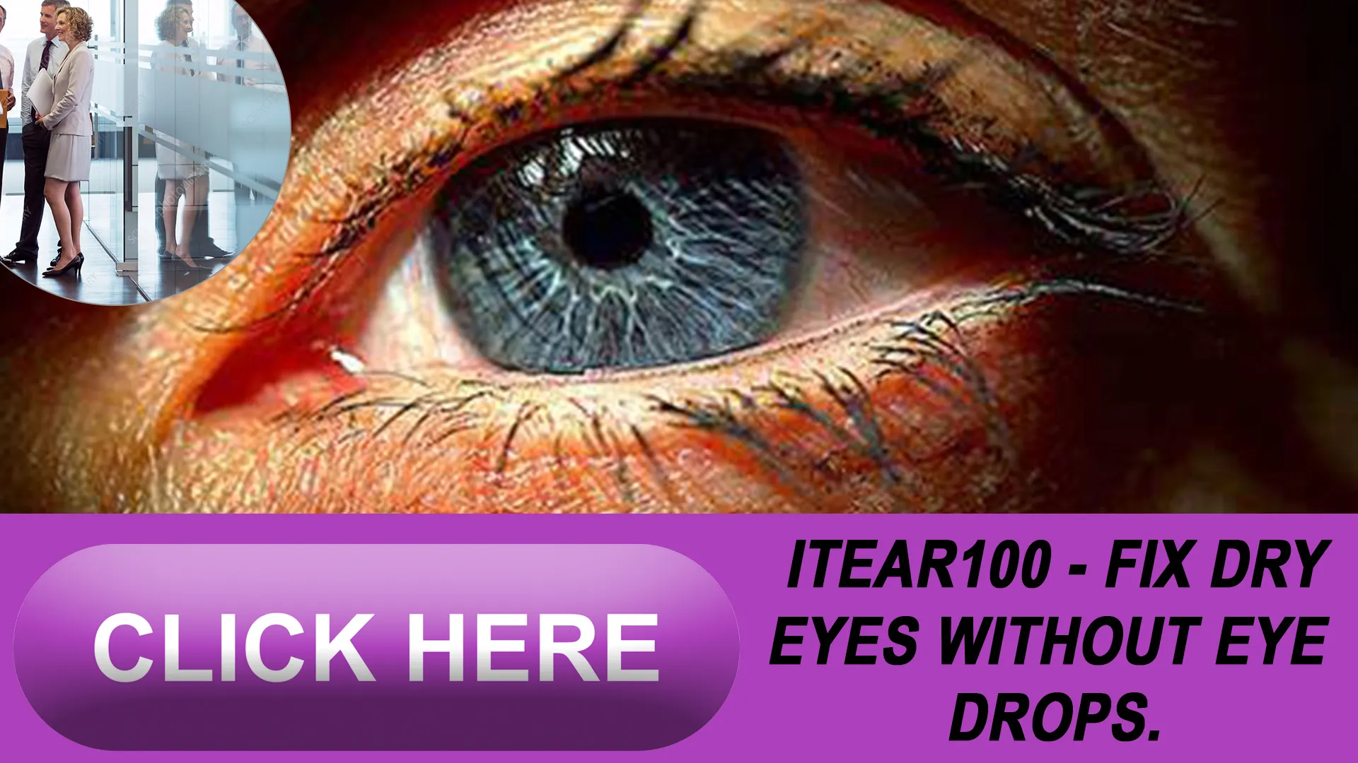 Identifying Expertise in Dry Eye Management