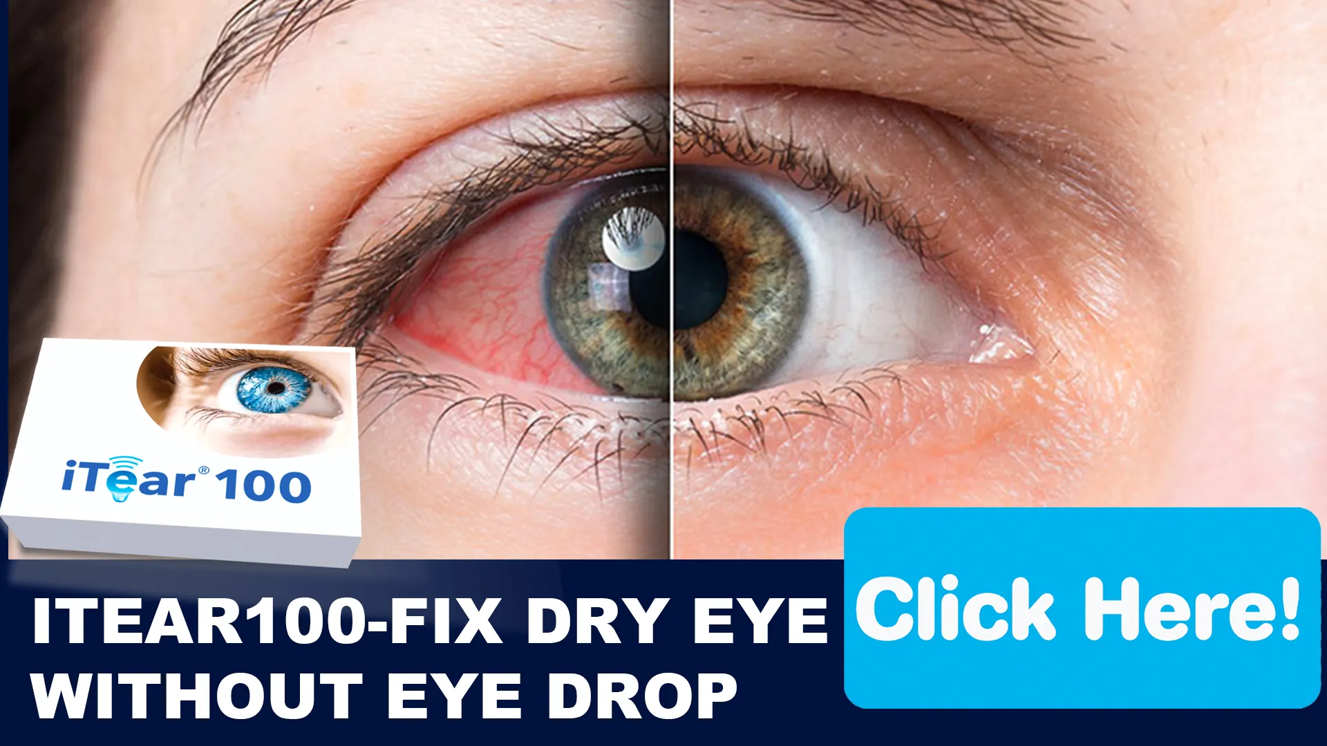 Getting to Know Chronic Dry Eye