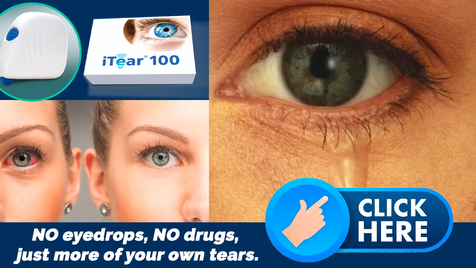 The iTEAR100 Experience - Innovation for Hydrated Eyes